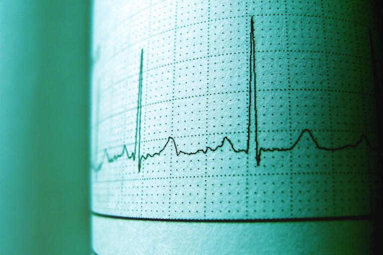 Monitoring managed Cloud Containers only